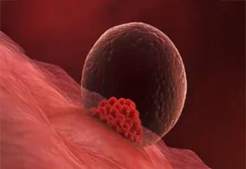 Endometrial Receptivity Analysis