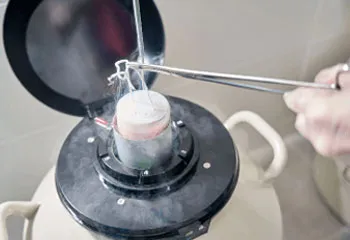 Oocyte Cryopreservation