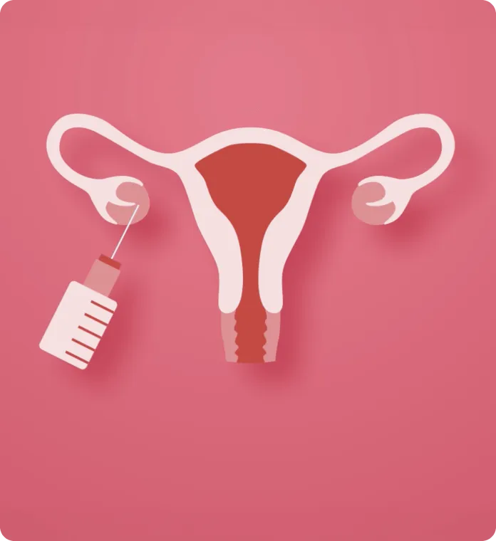 Stage 3 of IVF: Egg Retrieval