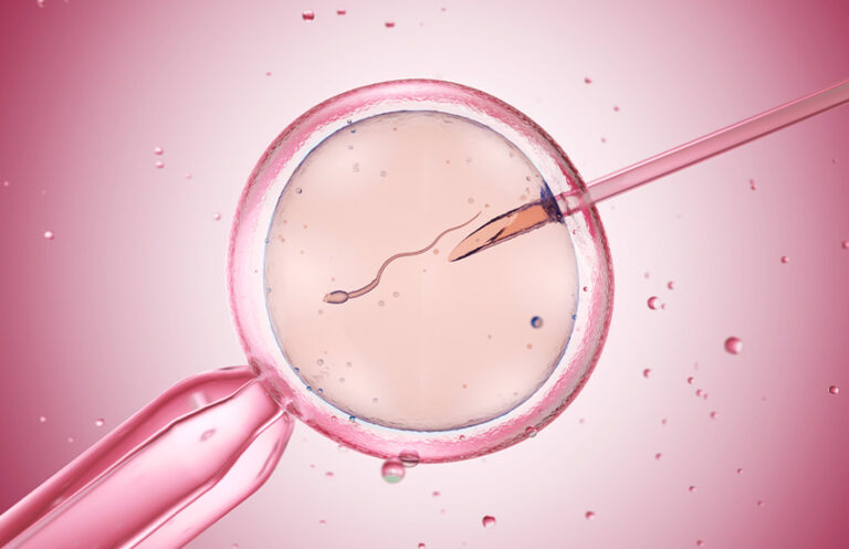 Understanding the IVF Journey Step by Step