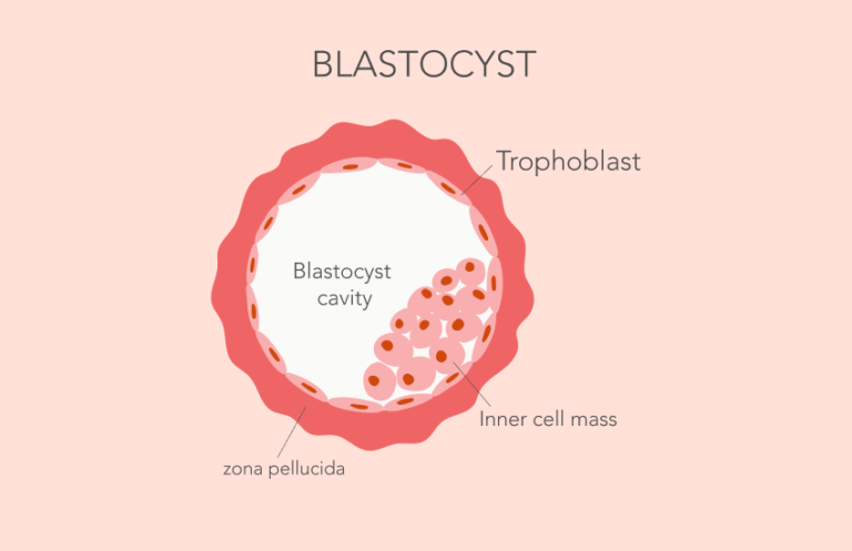 Blastocysts: How They Influence Fertility and Treatment Outcomes