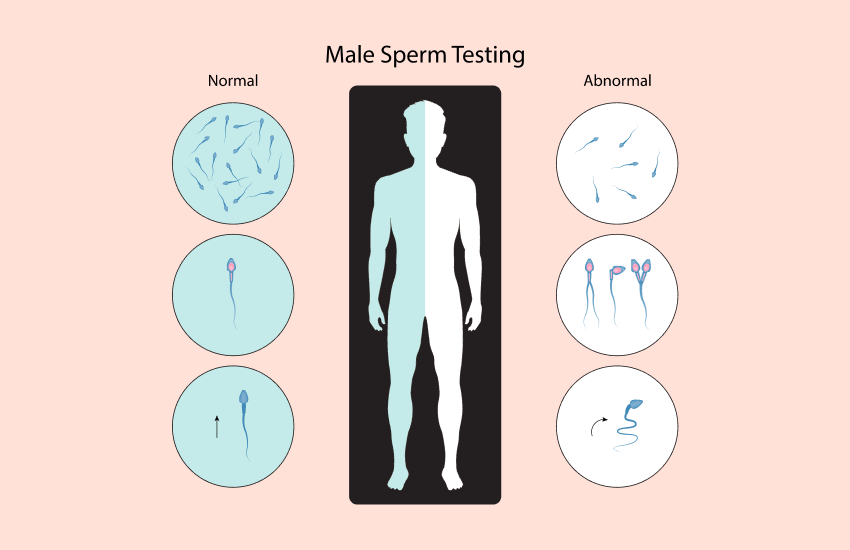 Understanding the importance of sperm analysis and its role in fertility