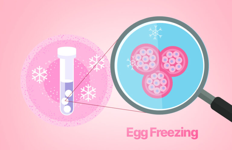 Preserving Fertility: Everything You Need to Know About Egg Freezing